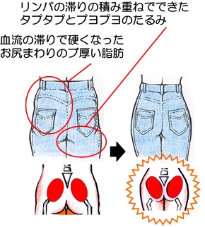 骨盤矯正での変化