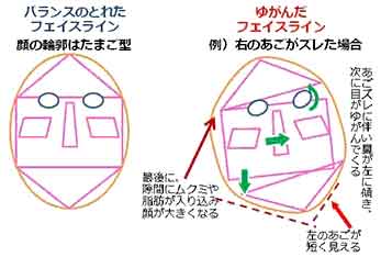 生活習慣によるゆがみの原因図