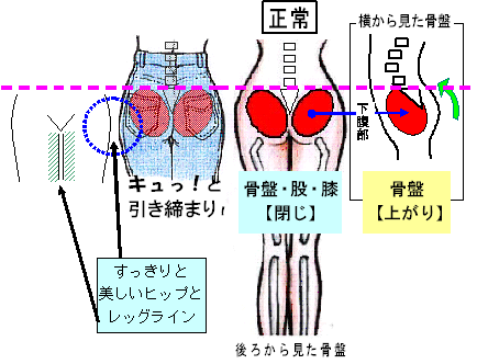 骨盤太り 開き ｏ脚ｘ脚の原因 昭島の会員制骨格矯正院プレイズ 骨格矯正院プレイズ